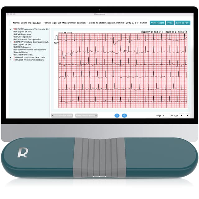 Livenpace 1-Lead Heart Health Monitor at Home, Portable 24 Hours Chest Lead Device with Free AI Analysis & PC Report, Rechargeable Recorder, HHM1