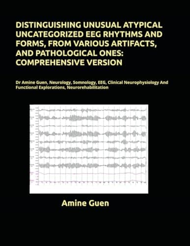 DISTINGUISHING UNUSUAL ATYPICAL UNCATEGORIZED EEG RHYTHMS AND FORMS, FROM VARIOUS ARTIFACTS, AND PATHOLOGICAL ONES: COMPREHENSIVE VERSION: Dr Amine ... Functional Explorations, Neurorehabilitation
