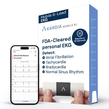 KardiaMobile 6L EKG Monitor, Medical-Grade, FDA-Cleared Heart Monitor, 6 Views of The Heart, Results in 30 Seconds, Unlimited Recordings, Works with Smartphones, HSA&FSA Eligible, Pocket-Size