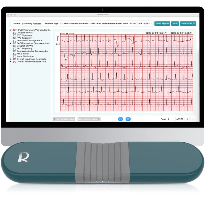 Livenpace 1-Lead Heart Health Monitor at Home, Portable 24 Hours Chest Lead Device with Free AI Analysis & PC Report, Rechargeable Recorder, HHM1