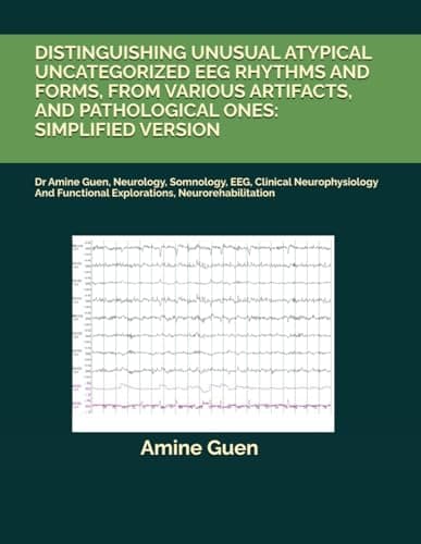 DISTINGUISHING UNUSUAL ATYPICAL UNCATEGORIZED EEG RHYTHMS AND FORMS, FROM VARIOUS ARTIFACTS, AND PATHOLOGICAL ONES: SIMPLIFIED VERSION: Dr Amine Guen, ... Functional Explorations, Neurorehabilitation