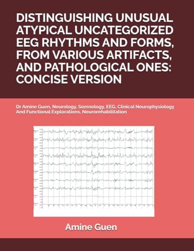 DISTINGUISHING UNUSUAL ATYPICAL UNCATEGORIZED EEG RHYTHMS AND FORMS, FROM VARIOUS ARTIFACTS, AND PATHOLOGICAL ONES: CONCISE VERSION: Dr Amine Guen, ... Functional Explorations, Neurorehabilitation